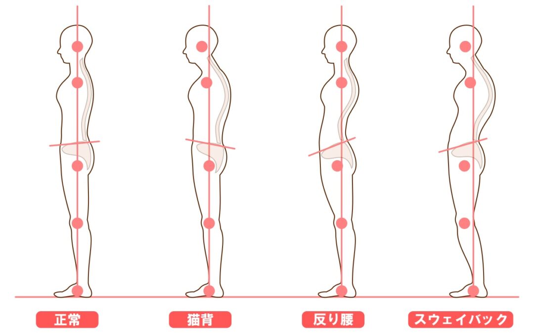 専門家が教える正しい姿勢と腰痛対策