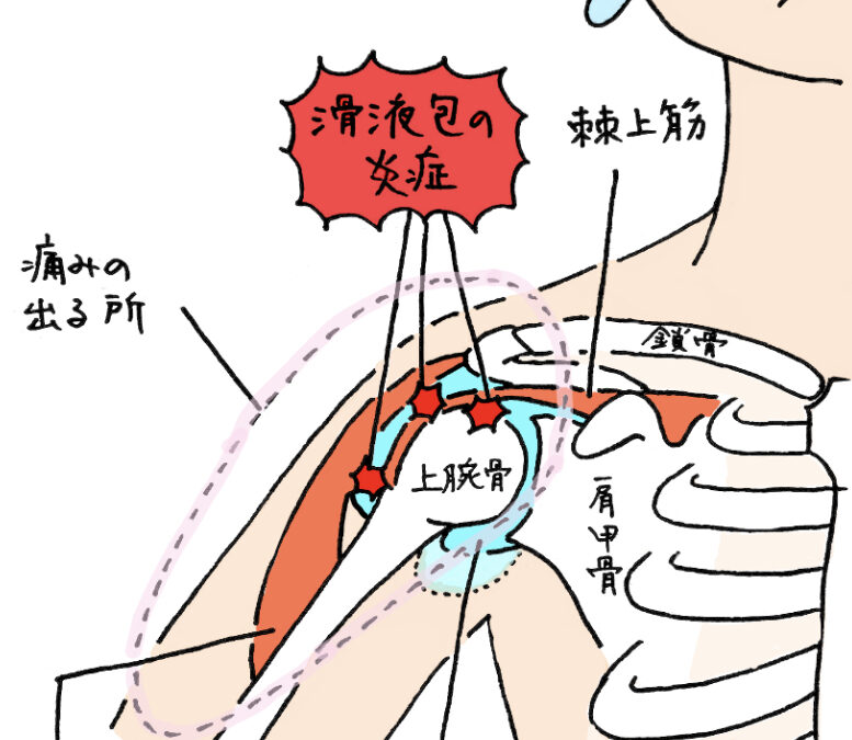 胸郭出口症候群の解消法！整体でできることとは？