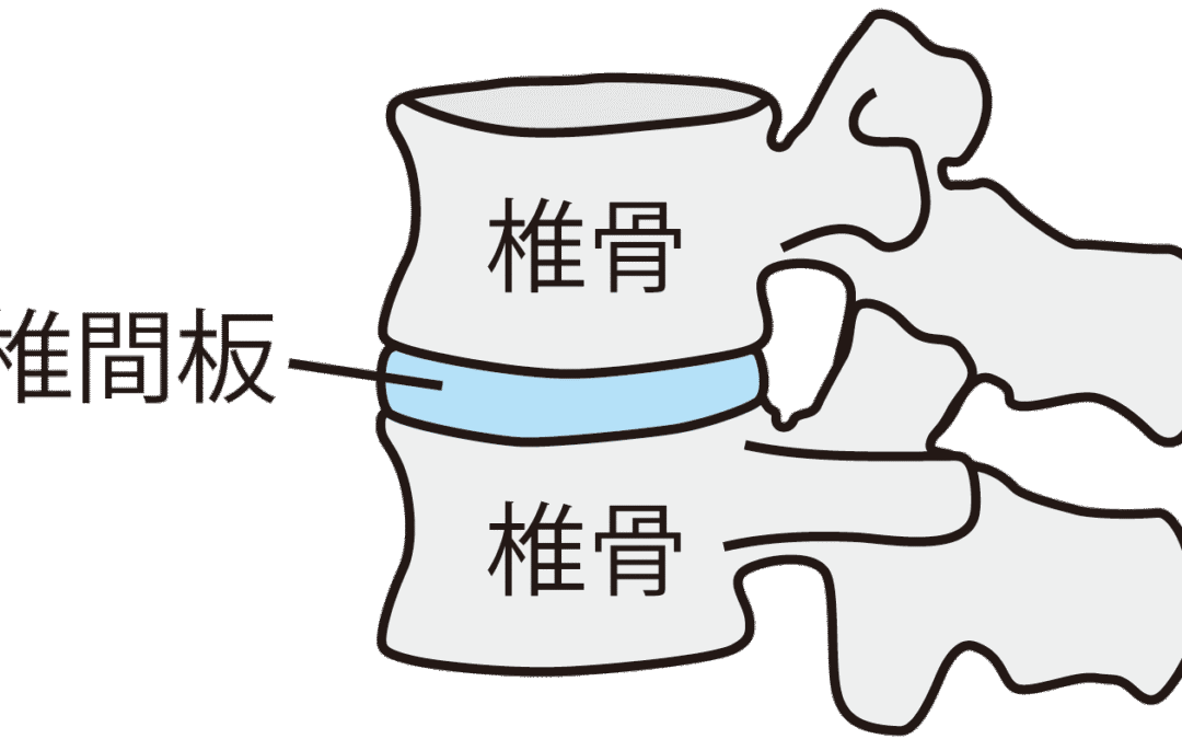 腰椎椎間板ヘルニアと睡眠：快適な寝方とマットレス選び